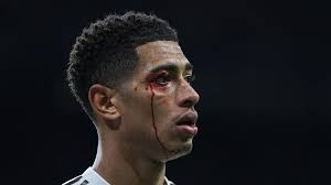 Kenapa Jude Bellingham Tidak Main Lawan Manchester City? Ini Penjelasannya